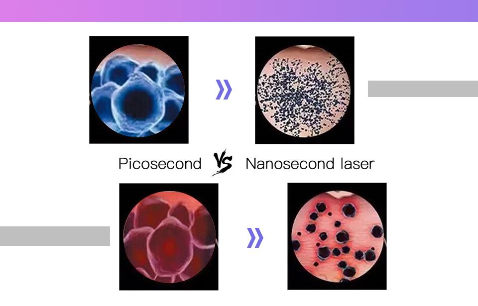 Portable Pico Second Laser Tattoo Removal 532nm/1064nm Pico Laser Nd Yag Laser System Portable Pico Second Laser Tattoo Removal 532nm/1064nm Pico Laser Nd Yag Laser System